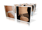 abdominoplasty
