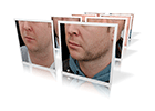 facial sculpting